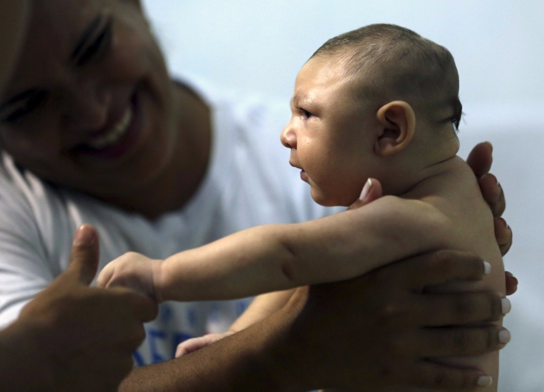 2015年源自巴西的兹卡疫情，蔓延全球30多个国家。兹卡病毒将导致孕妇生下小脑症的婴儿，研究发现成年人的头脑也可能受影响。