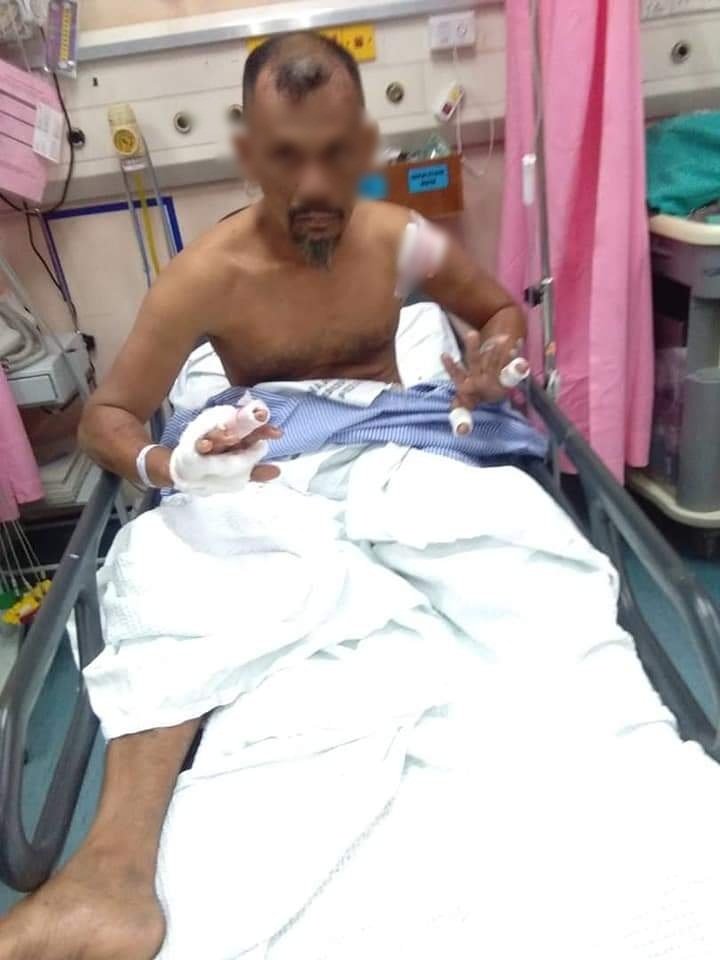 山猪袭击甘榜民宅，其中一名村民受伤入院。