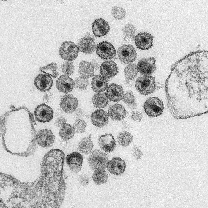在电子显微镜下的HIV病毒。（图取自美国疾病控制和预防中心）