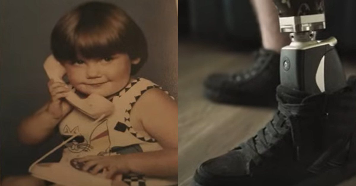 左图：小时候的霍尼卡特是个胖胖的可爱女孩。右图：霍尼卡特之前因脚伤在医院接受治疗时发生细菌感染，导致一条腿的膝盖以下截肢