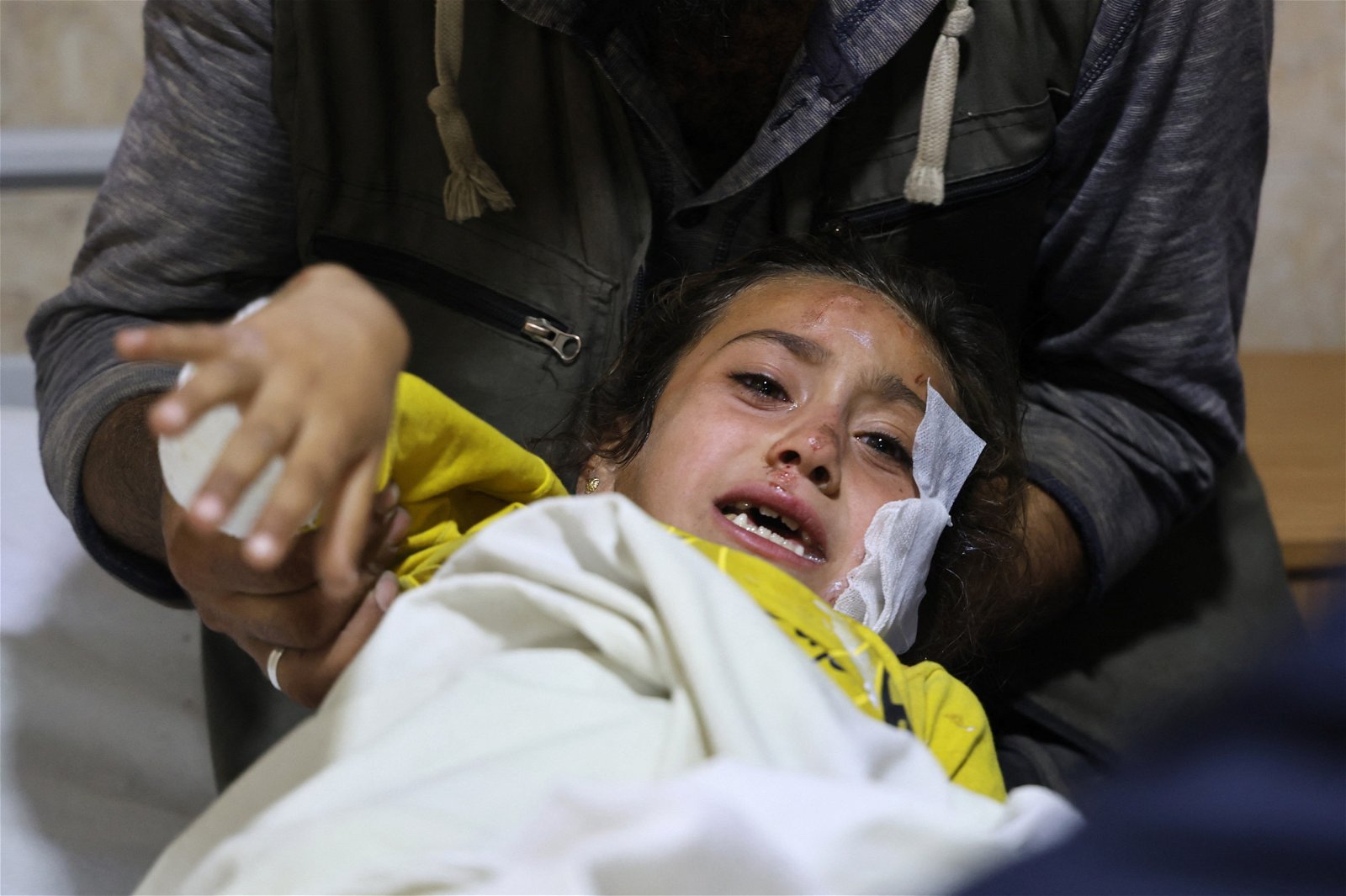 在叙利亚霍姆斯省一所军事学院当地时间周四遭到袭击后，叙利亚政府军当天对反对派控制的伊德利卜地区，进行了全天的猛烈轰炸，造成5名平民丧生。图为伊德利卜地区一名受伤的女孩正在接受治疗。（图取自法新社）
