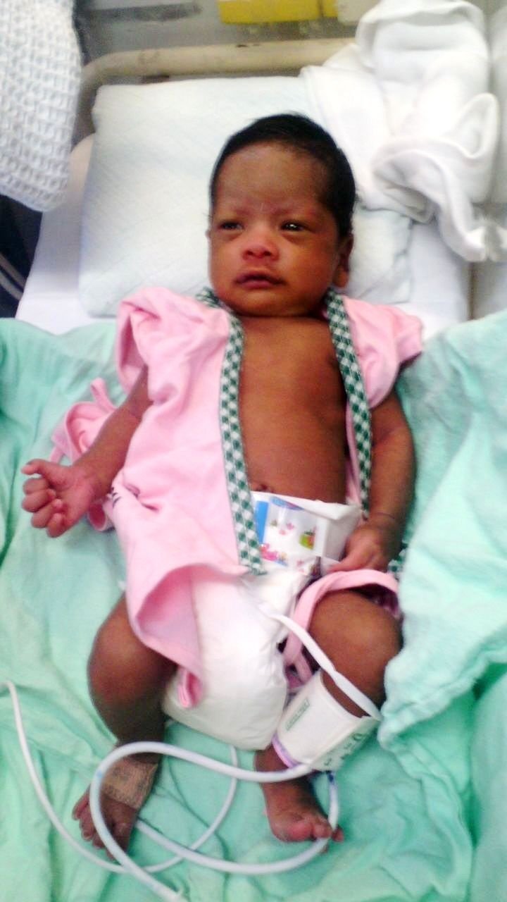 女婴诺嘉娜患先天性心脏病，需要9万令吉动手术。