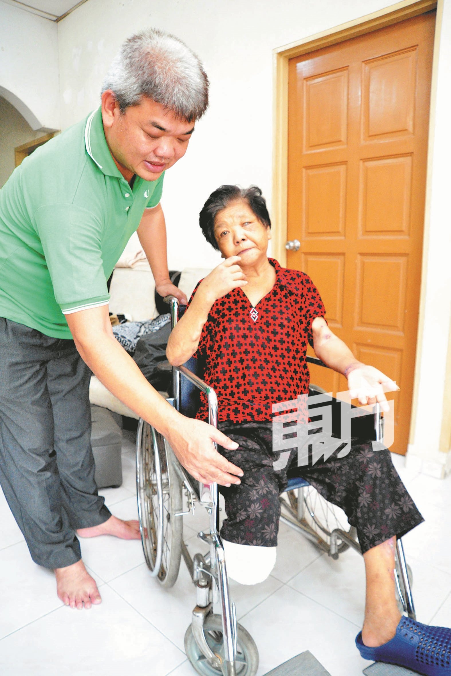 许亚妹（右）右脚截肢，行动不便， 图为吴锦豪（左）小心照料其伤口。