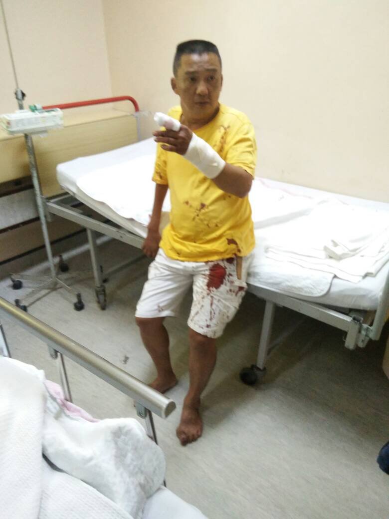 被砍伤的哥哥左手伤势严重，被救护车送往怡保苏丹后端姑拜浓医院医治。
