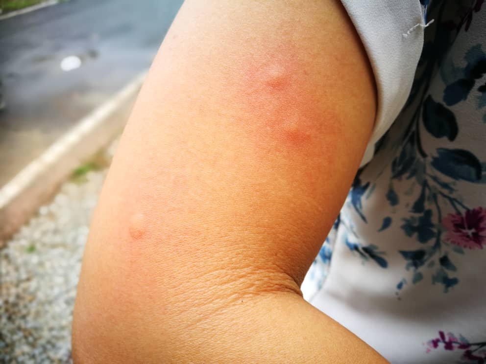 槟州课外活动中心自制酵母捕蚊器，不过也只是捕捉蚊子，无法解决孑孓问题。