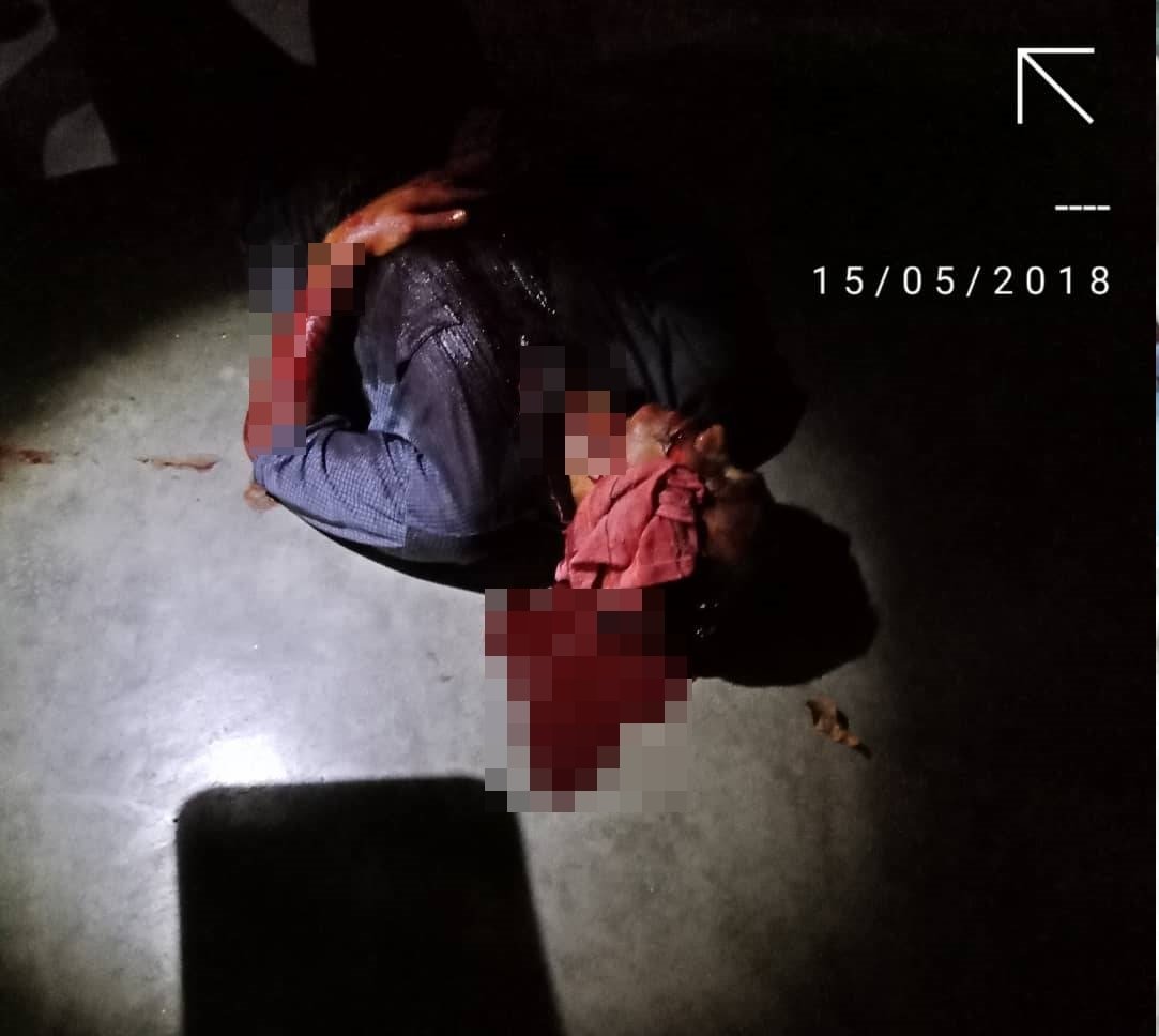 一名拥有伍长警阶的警员遭缅甸籍男子持刀挥砍，其左脸颊更被挥砍至皮开肉绽，鲜血直流。