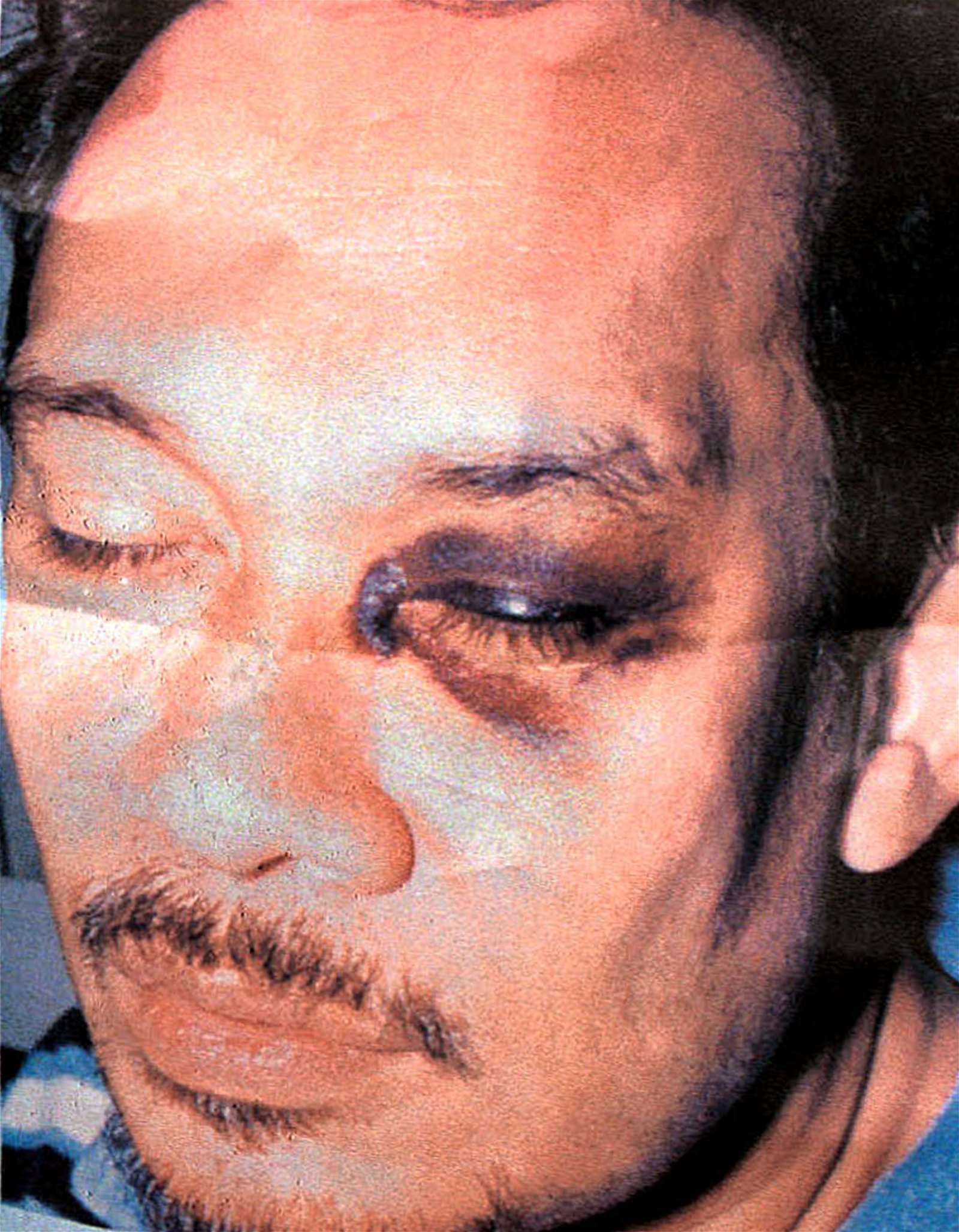 1998年9月20日安华在内安法令下遭逮捕，并被控渎职及肛交罪名。安华在被扣留期间遭殴打，导致9月29日出庭时，带著瘀青的黑眼圈。