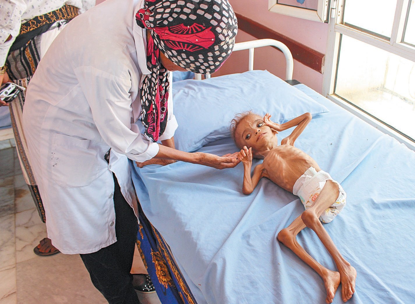 也门西北部哈杰省一家医院里，一名医护人员正呵护著一名躺在病床上营养不良的儿童。也门政府军及反抗军“青年运动”持续3年的战争，已将该国推向饥荒边缘。而营养不良和糟糕的卫生条件，让这个国家面对世界大多数地方只会在历史书籍里发现的疾病，束手无策。