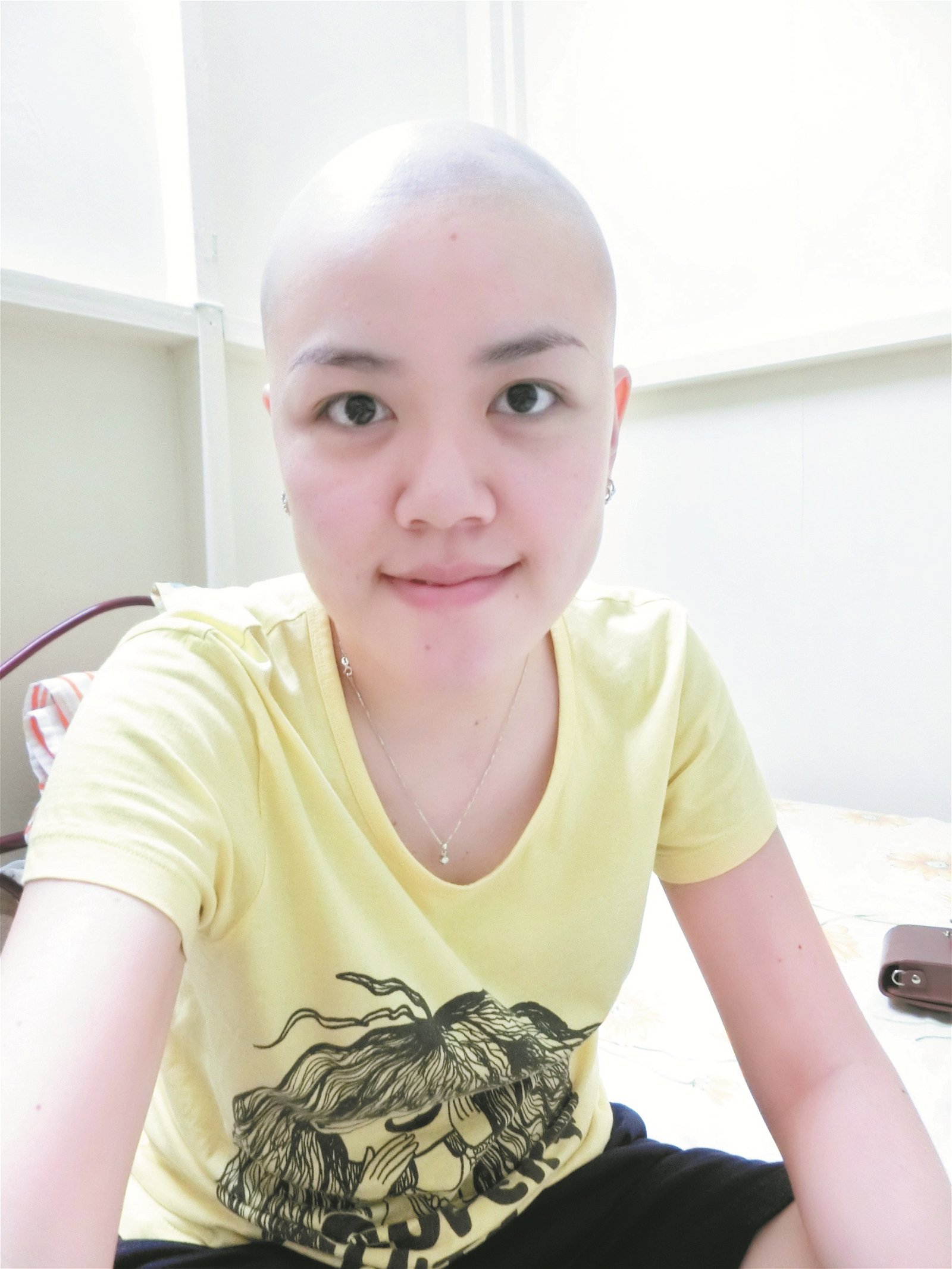 剃掉头发的徐紫恩依然美丽，她把自己光头的样子拍下，一方面当成日记，另一方面希望透过社交媒体分享自己的故事，能鼓励正在抗癌的病患。