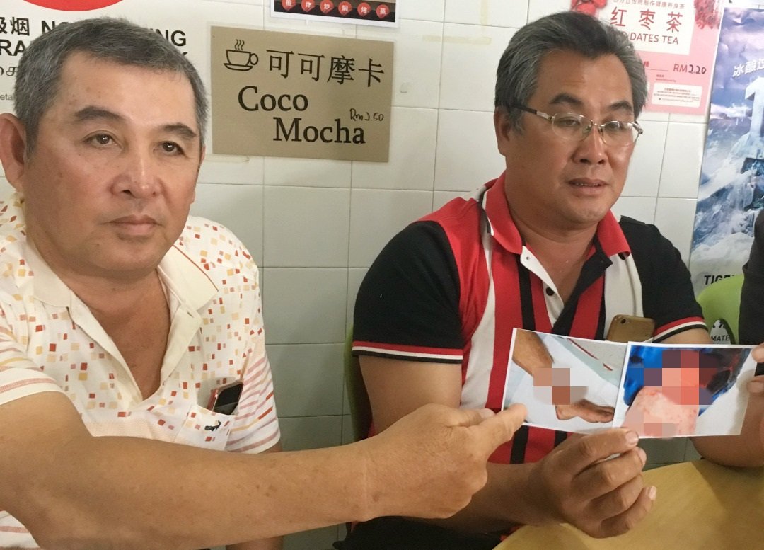 陈俊辉（右）不满一年前遭人砍伤的案件，如今已遭警方结案处理，左为其兄长陈俊英。