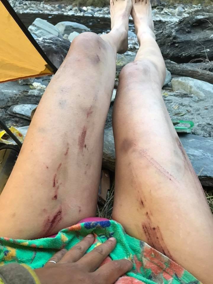 吴季芸12月24日曾发文分享25天的登山路线，事后却在留言处发了修长双腿满是擦伤、瘀青的照片。