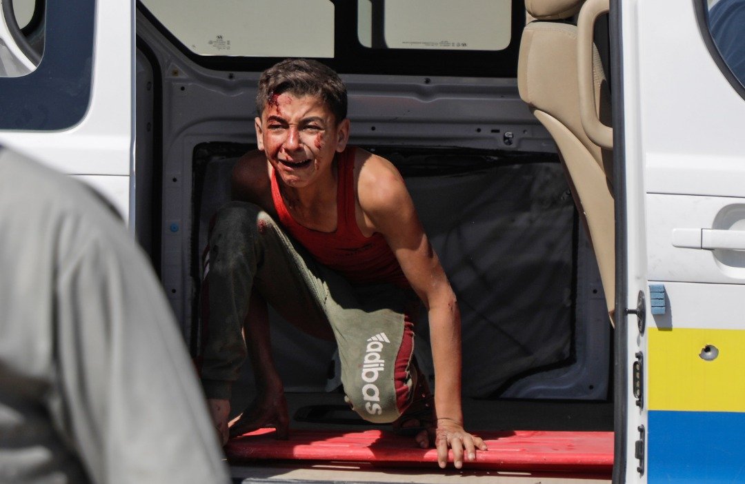 迈阿赖努阿曼郊区的卡法罗马遭到空袭后，一名头部受伤的男孩，在救护车内惊恐地嚎啕哭泣。当地救援人员指出，自政府军实行空袭行动以来，已有至少10名民众死亡。