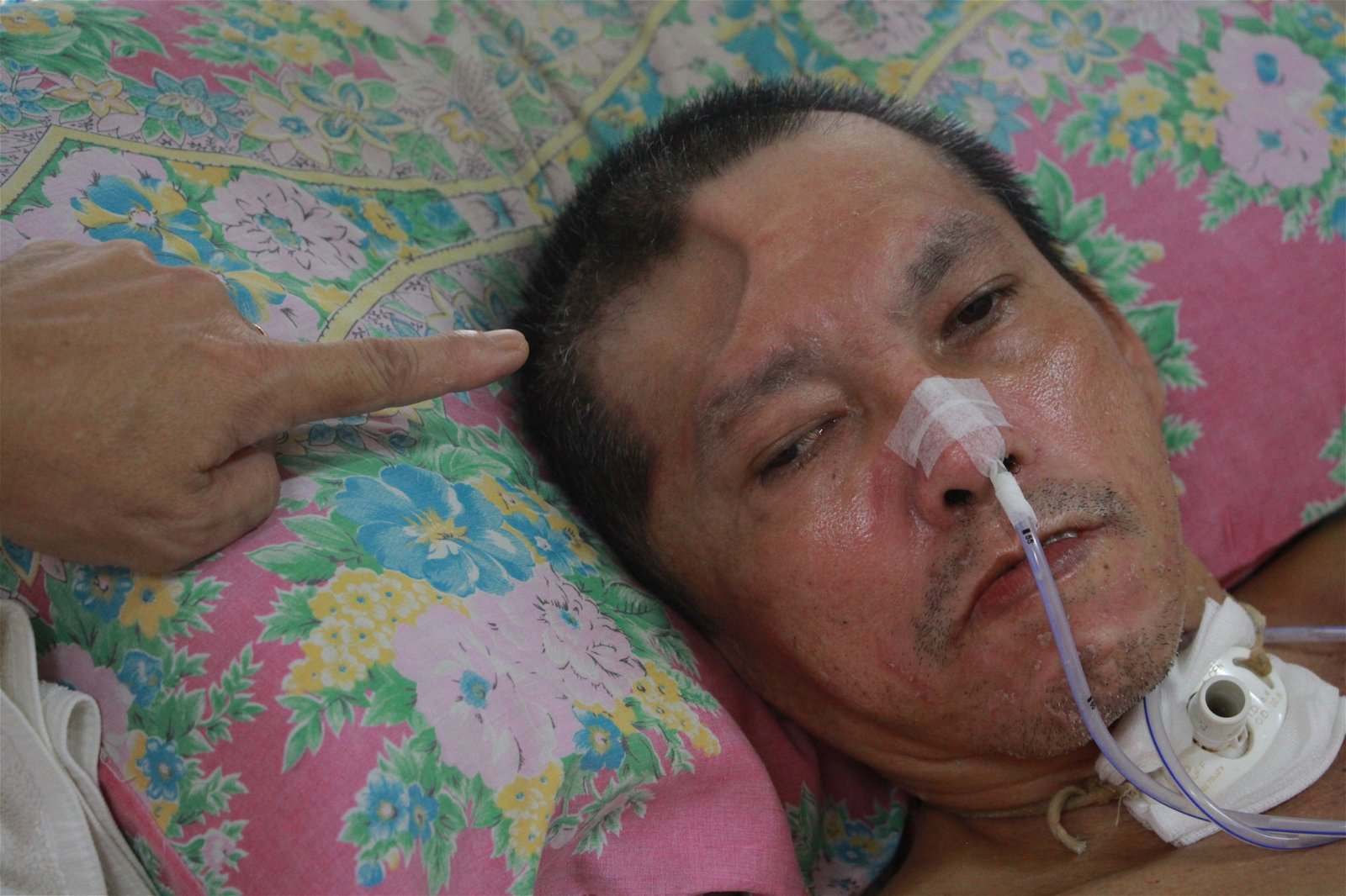 李甫明因一场车祸，导致其右脑严重受伤，目前还无法开口说话。