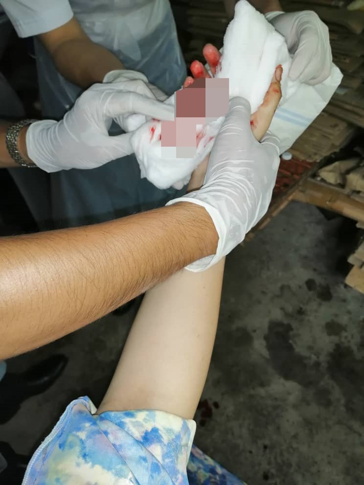 女子的手指脱离机器后，由医务人员包扎止血及送往医院进一步治伤！