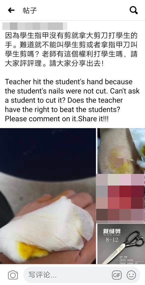社交媒体广泛流传一则图文并茂的贴文，指有关学生因没剪指甲，遭老师以剪刀打手兼刺伤。