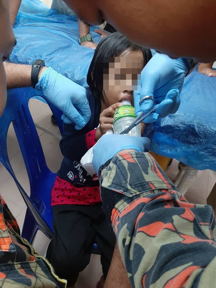 消防员耗时28分钟动用特殊剪刀成功将女童舌头从水瓶中取出。