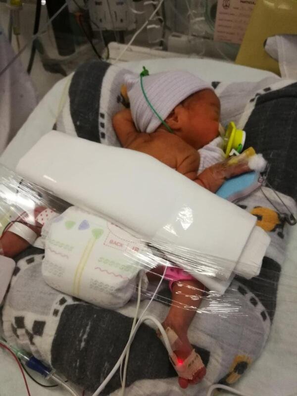 谢明珍女儿一度在新生儿加护病房的保温箱里住了约一个月。（受 访者提供）