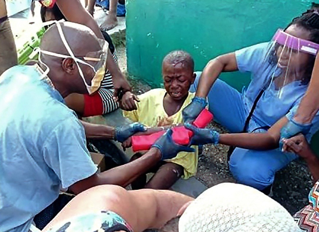 大湾省首府热雷米受灾严重，医院伤者人满为患，这是古巴医疗队成员在为一名遭遇手臂骨折的小孩作紧急处理。（图取自古巴国际新闻中心/法新社）