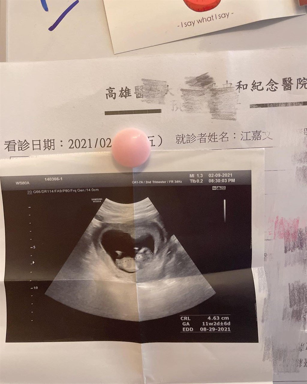 变性网红罔腰18日在IG贴出在高医做的腹部超音波纪录单，公布怀孕喜讯。