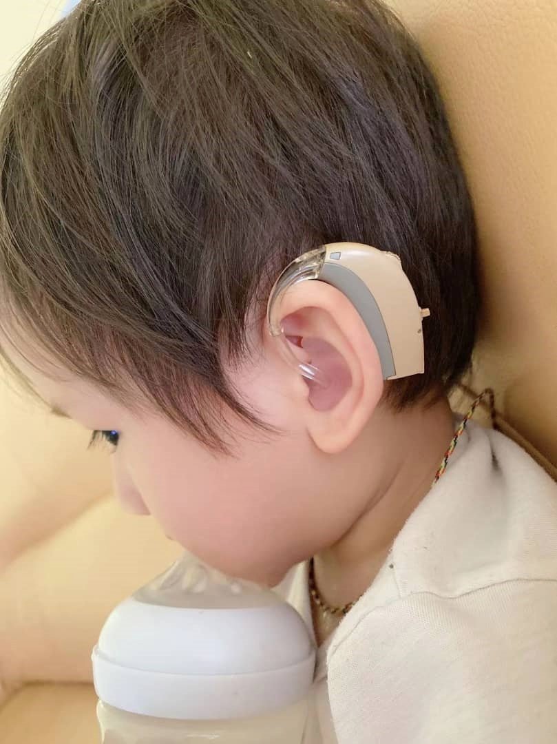 虽然承澔耳朵佩戴助听器，但仍然起不了作用，需要植入人工耳蜗。
