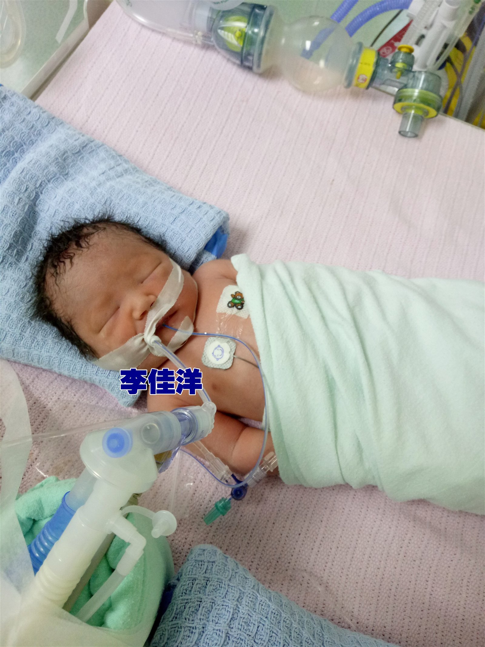 李佳洋出世的第7天就因为严重心疾动了第一次手术。