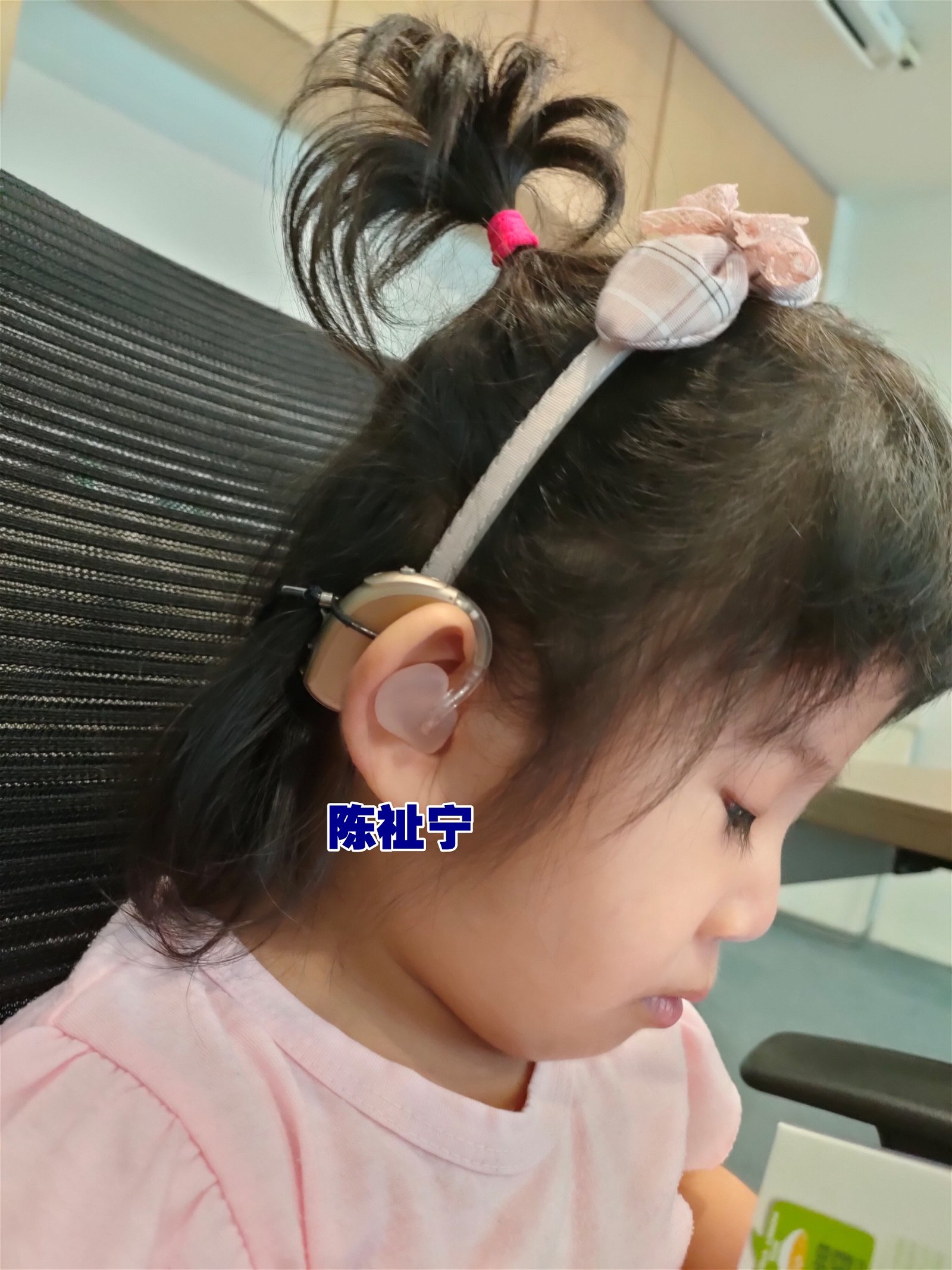 :陈祉宁两个月大时切除脑瘤落下双耳听力损失后遗症，期盼大家助她恢复听力。