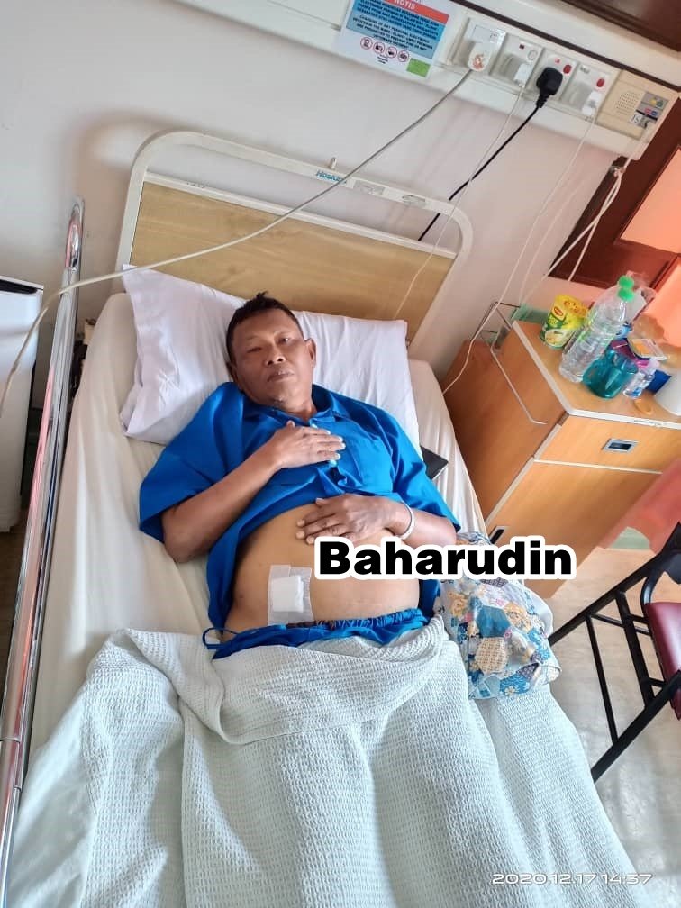 巴哈鲁丁在手术前，肚子严重肿胀。