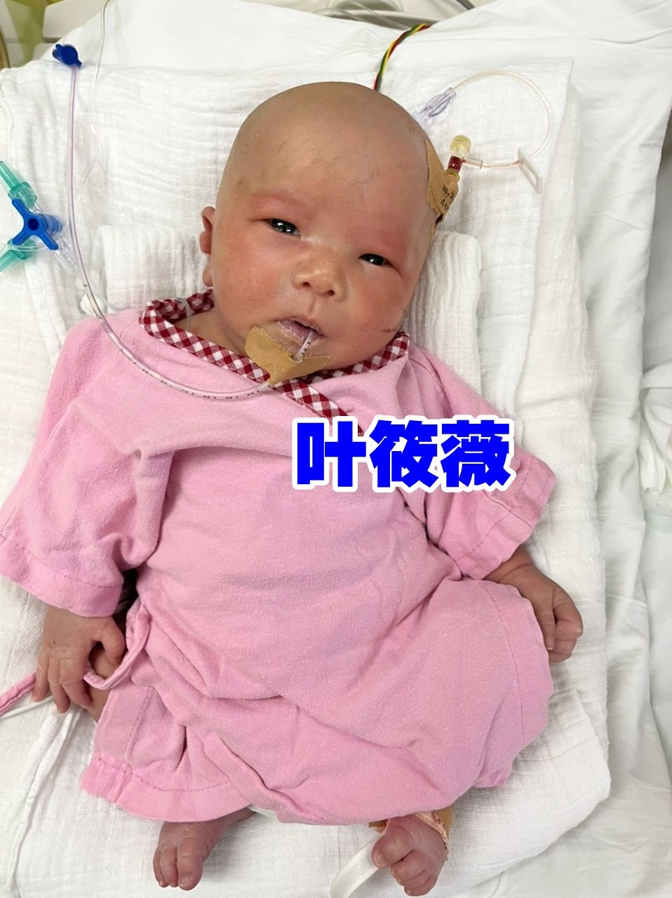女婴叶筱薇有坚韧的生命力，她需要8万令吉进行心脏手术。