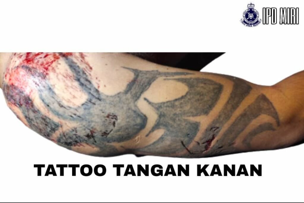 警方希望通过死者右手臂纹身图案以便取得死者身份背景。