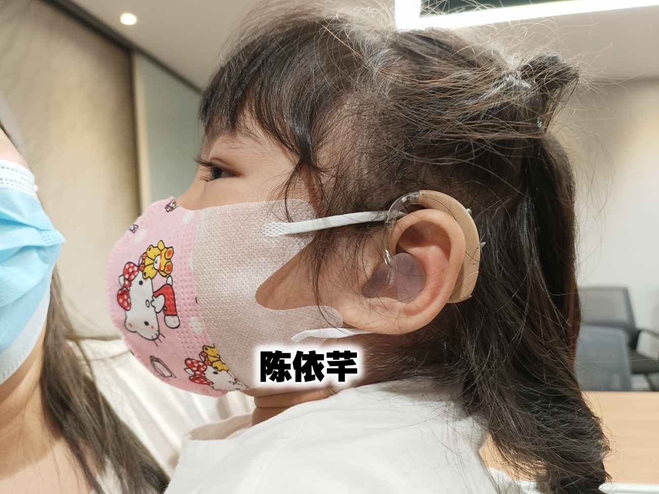 4岁的依芊双耳重听，医生已鉴定她的双耳适合植入人造耳蜗。