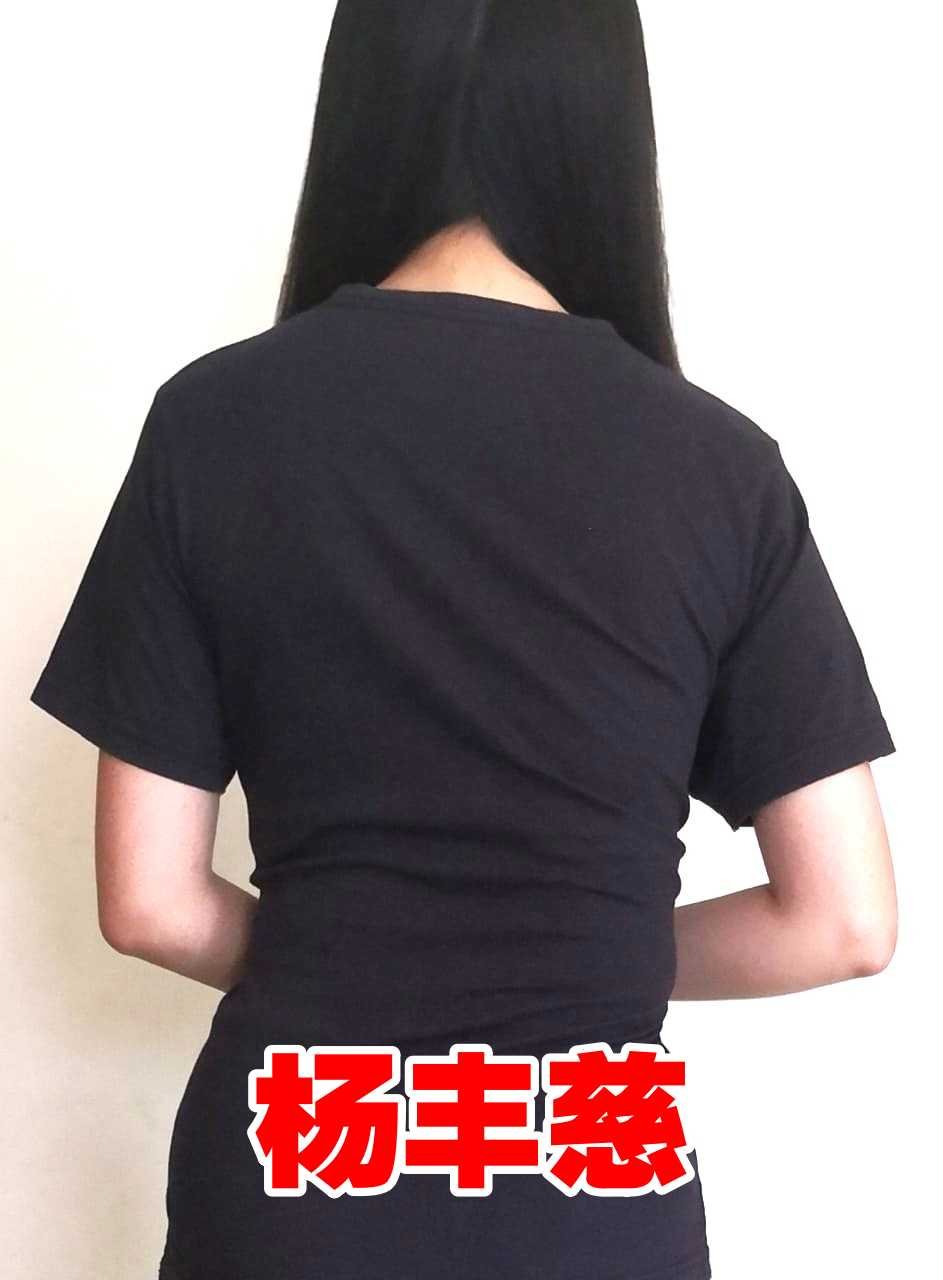 杨丰慈两侧肩膀不平，背部一侧隆起。
