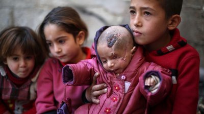 叙利亚男婴卡里姆被战火波及，左眼失明。许多人纷纷上传遮住自己一只眼睛的照片，呼吁外界正视叙利亚内战所造成的伤害。