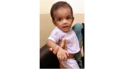 峇株1岁9个月男童莫哈末阿法迪，疑被养父母虐待。