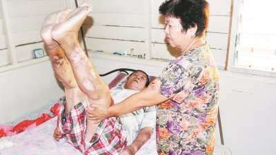 邱文偕在妻子廖春兰的协助下，示范其每日进行的物理治疗动作，以确保大腿肌肉不会退化萎缩。