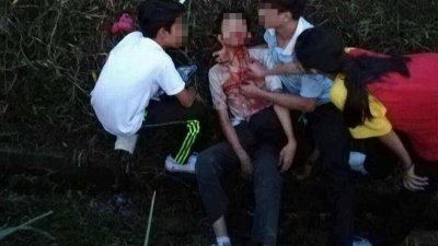 少年遭石块砸伤脸部后血流不止，最终在友人的协助下，送往医院接受治疗。