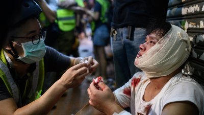荃湾在周一入夜后爆发白衣人和黑衣人互相激烈殴斗，一名头破血流的白衣男子坐在街边接受治疗。