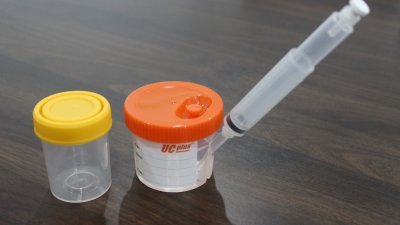和德有限公司推出的新改良尿杯（右），比普通的尿杯（左）更为方便，其中附设的针筒可充当手柄，方便使用者收集尿液，也方便化验人员的后续工作。