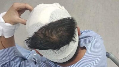 和丰一名年轻华商的头部被人连砍多刀，缝了20余针保命，如今在怡保一家私人医院接受观察。