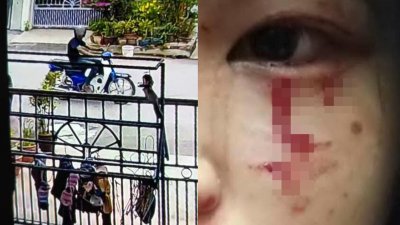 疑似匪徒的印裔男子骑著摩哆出现在新邦安拔廷高花园一带(左图)。少女所戴的眼镜被匪徒击破，玻璃碎片割伤眼角，鲜血直流。