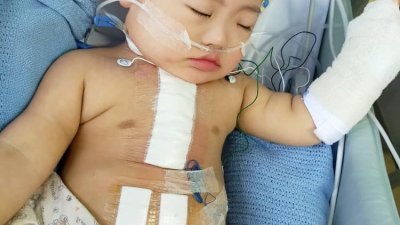 刘㭏家手术成功，目前在医院观察。