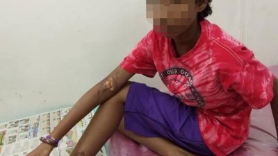 10岁印裔女童的身上被发现疑似遭被灼热的铁灼伤的伤口。