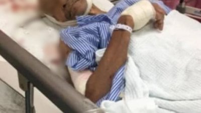 70岁巫裔老翁沙里夫被山猪袭击，在医院观察治疗。