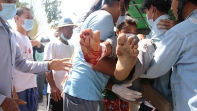 缅甸全国抗议示威活动持续，军方周日再次向示威者开枪，至少7人丧命，大约40人受伤。这是在南部城市土瓦，一名受伤的抗议者被抬上车送往治疗。（照片：：Dawei Watch/路透社）