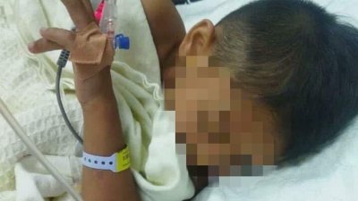 5岁男童被一条黑色眼镜蛇咬伤，陷入昏迷。