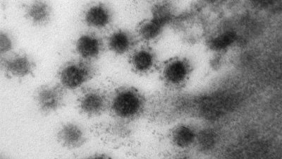 俄罗斯“矢量”病毒学与生物技术国家科学中心，周一首度公布由电子显微镜拍摄的新冠肺炎变种病毒Delta图像。（图源自俄罗斯“矢量”病毒学与生物技术国家科学中心）