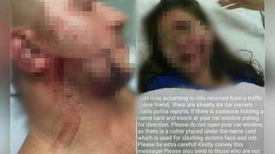 社交媒体疯传新加坡游客在柔佛遇劫受伤的假消息。（档案照）