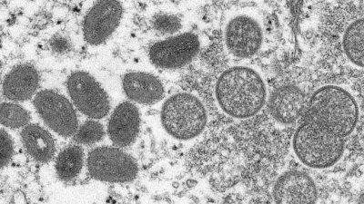 电子显微镜下成熟的椭圆形猴痘病毒（左）和球形未成熟病毒（右）。