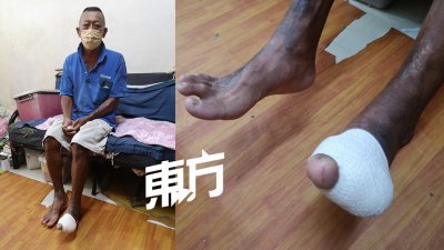 江坤星患上肾病，每周必须洗肾3次，因脚部细菌感染，必须截断部分脚趾，让他只能偶尔接散工，赚取微薄收入。