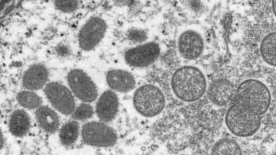 电子显微镜 (EM) 图像显示，成熟的椭圆形猴痘病毒颗粒以及未成熟病毒粒子的新月体和球形颗粒。（图取自美国疾病控制和预防中心/路透社）