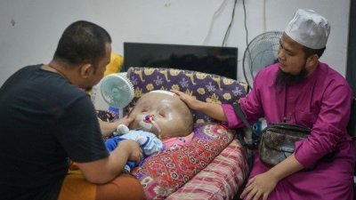 Ebit Lew（右）探访居林一名患有“大头症”的婴孩Bilal，并希望专家能协助治疗这名宝宝。